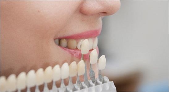 El Colegio de Odontólogos de Cataluña advierte del fraude existente en los tratamientos de carillas dentales con publicidad engañosa de algunas clínicas low cost